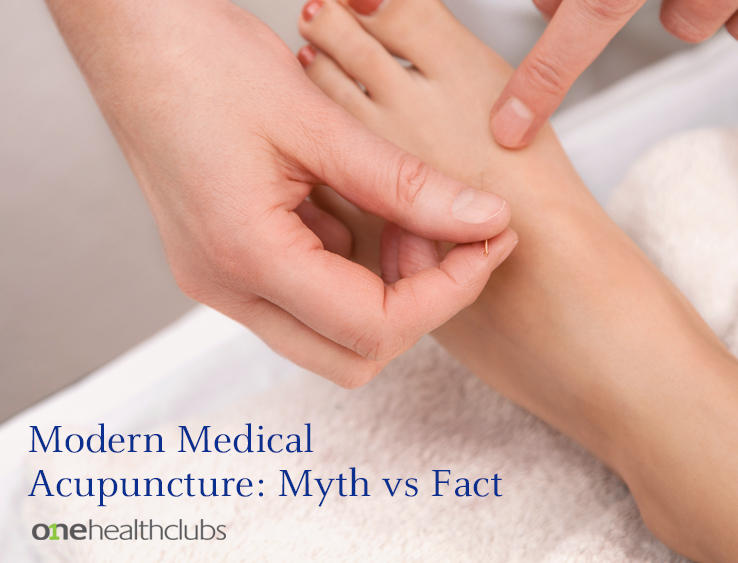 Modern Medical Acupuncture: Myth vs. Fact